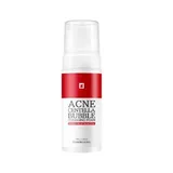 TOSOWOONG - Acne Centella Bubble Cleansing Foam