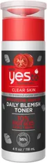 Tomatoes Detoxifying Charcoal Daily Blemish Tonic