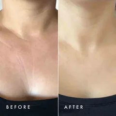 Über Youth™ - Neck & Chest Super Lift Serum-Spray