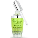Advanced Acne Serum