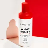 What Acne? - Balancing and Clarifying Toner