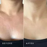 Über Youth™ - Neck & Chest Super Lift Serum-Spray
