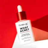 What Acne? - Hydrating & Healing Serum
