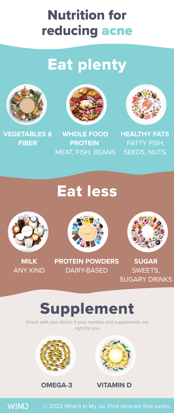 Nutrition against acne latest research summary by WIMJ